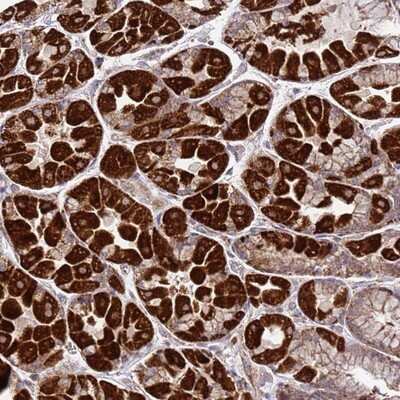 Immunohistochemistry-Paraffin: FBXO33 Antibody [NBP1-91890]