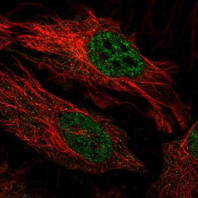 Immunocytochemistry/ Immunofluorescence: FBXO34 Antibody [NBP2-31919]