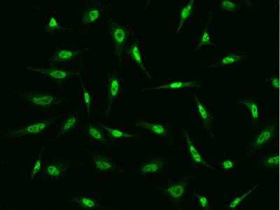 Immunocytochemistry/ Immunofluorescence: FBXO34 Antibody [NBP3-06221]