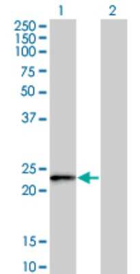 Western Blot: FBXO36 Antibody (3D3) [H00130888-M02]