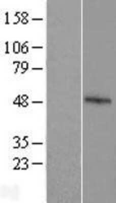 Western Blot: FBXO39 Overexpression Lysate [NBL1-10634]