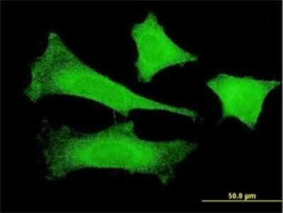 Immunocytochemistry/ Immunofluorescence: FBXO4 Antibody (2F2) [H00026272-M02]