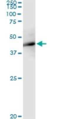 Immunoprecipitation: FBXO4 Antibody (2F2) [H00026272-M02]