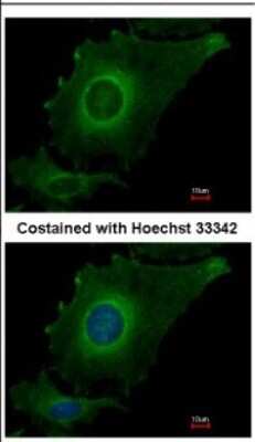 Immunocytochemistry/ Immunofluorescence: FBXO4 Antibody [NBP2-21608]