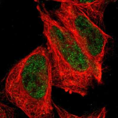 Immunocytochemistry/ Immunofluorescence: FBXO4 Antibody [NBP2-58623]