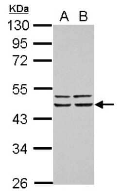 Western Blot: FBXO4 Antibody [NBP2-16450]