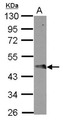 Western Blot: FBXO4 Antibody [NBP2-21608]