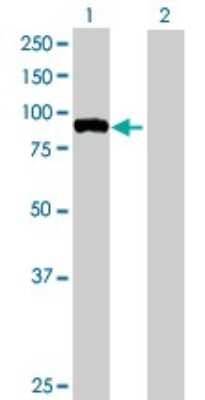 Western Blot: FBXO40 Antibody [H00051725-B01P]