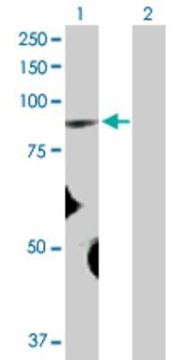 Western Blot: FBXO40 Antibody [H00051725-D01P]