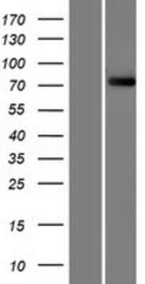 Western Blot: FBXO40 Overexpression Lysate [NBP2-07059]