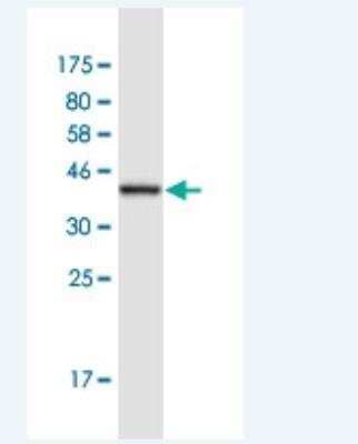 Western Blot: FBXO41 Antibody (6B6) [H00150726-M02-100ug]