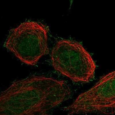 Immunocytochemistry/ Immunofluorescence: FBXO41 Antibody [NBP2-58465]