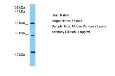 Western Blot: FBXO41 Antibody [NBP2-87435]