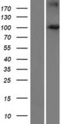 Western Blot: FBXO41 Overexpression Lysate [NBP2-08488]