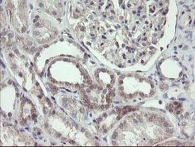 Immunohistochemistry: FBXO42 Antibody (OTI1H4) [NBP2-45621]