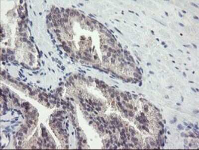 Immunohistochemistry: FBXO42 Antibody (OTI1H4) [NBP2-45621]