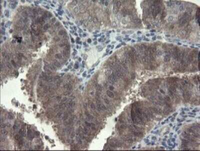 Immunohistochemistry: FBXO42 Antibody (OTI1H4) [NBP2-45621]