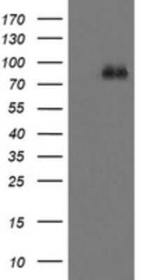 Western Blot: FBXO42 Antibody (OTI1H4) [NBP2-45621]