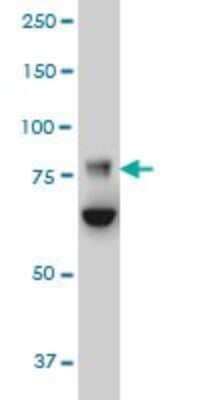 Western Blot: FBXO42 Antibody (2F10) [H00054455-M02]