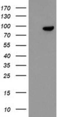Western Blot: FBXO42 Antibody (OTI2G7) [NBP2-03909]