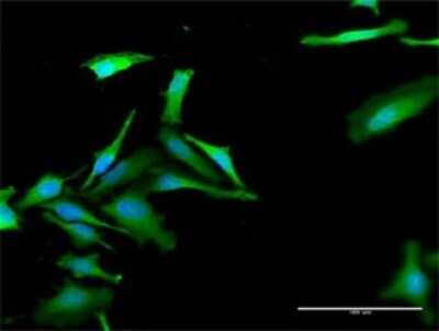 Immunocytochemistry/ Immunofluorescence: FBXO42 Antibody [H00054455-D01P]