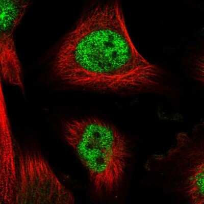 Immunocytochemistry/ Immunofluorescence: FBXO42 Antibody [NBP1-84711]