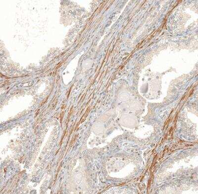 Immunohistochemistry-Paraffin: FBXO42 Antibody [NBP1-84711]