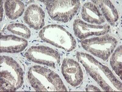 Immunohistochemistry: FBXO42 Antibody (OTI1H4) - Azide and BSA Free [NBP2-71960]