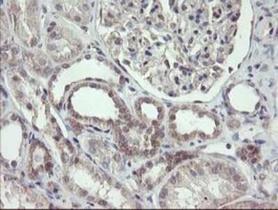 Immunohistochemistry: FBXO42 Antibody (OTI1H4) - Azide and BSA Free [NBP2-71960]