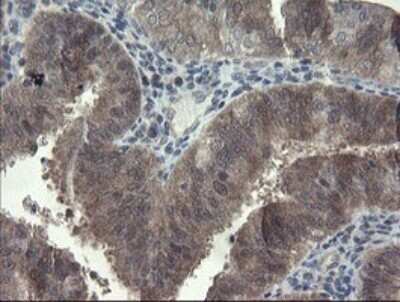 Immunohistochemistry: FBXO42 Antibody (OTI1H4) - Azide and BSA Free [NBP2-71960]