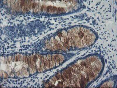 Immunohistochemistry: FBXO42 Antibody (OTI2G7) - Azide and BSA Free [NBP2-71958]