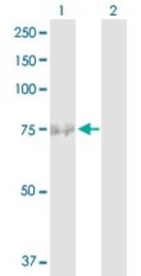 Western Blot: FBXO42 Antibody [H00054455-D01P]