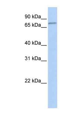 Western Blot: FBXO42 Antibody [NBP1-56643]