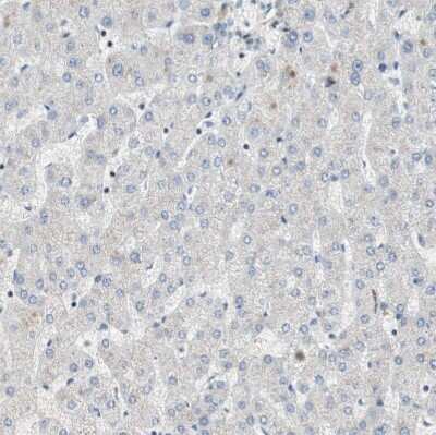 Immunohistochemistry-Paraffin: FBXO44 Antibody [NBP1-84728]