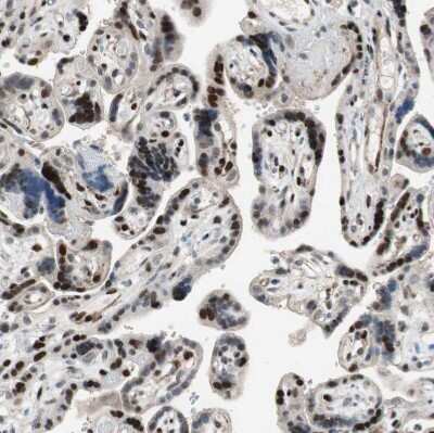 Immunohistochemistry-Paraffin: FBXO44 Antibody [NBP1-84728]