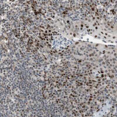 Immunohistochemistry-Paraffin: FBXO44 Antibody [NBP1-84728]