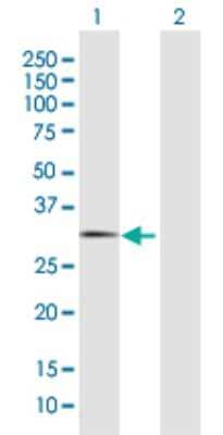 Western Blot: FBXO44 Antibody [H00093611-D01P]