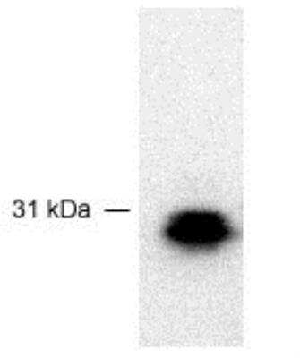 Western Blot: FBXO44 AntibodyBSA Free [NB100-467]