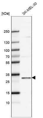 Western Blot: FBXO44 Antibody [NBP1-84728]