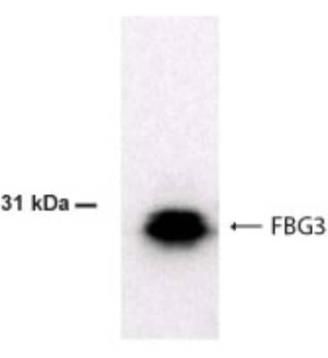 Western Blot: FBXO44 Antibody [NBP2-24386]