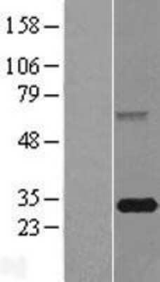 Western Blot: FBXO44 Overexpression Lysate [NBL1-10638]