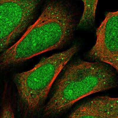 Immunocytochemistry/ Immunofluorescence: FBXO46 Antibody [NBP2-31891]