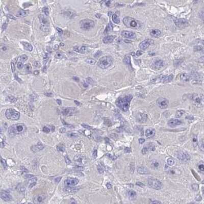 Immunohistochemistry: FBXO47 Antibody [NBP2-31679]
