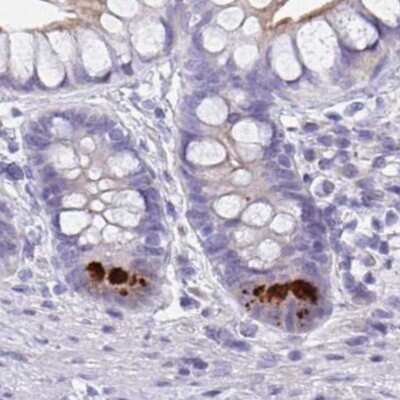 Immunohistochemistry: FBXO47 Antibody [NBP2-31679]