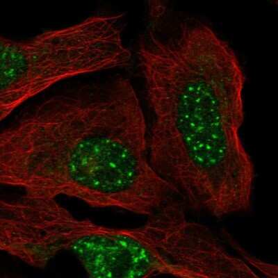 Immunocytochemistry/ Immunofluorescence: FBXO48 Antibody [NBP2-14691]