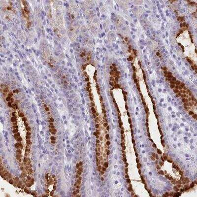 Immunohistochemistry-Paraffin: FBXO48 Antibody [NBP2-14691]