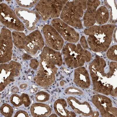 Immunohistochemistry-Paraffin: FBXO6 Antibody [NBP2-14012]