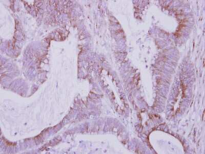 Immunohistochemistry-Paraffin: FBXO6 Antibody [NBP2-16451]