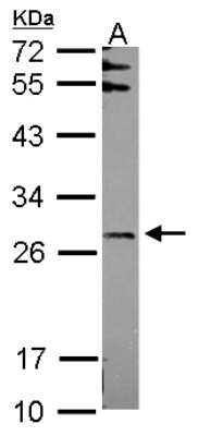 Western Blot: FBXO6 Antibody [NBP2-16451]