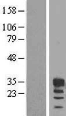 Western Blot: FBXO6 Overexpression Lysate [NBL1-10640]